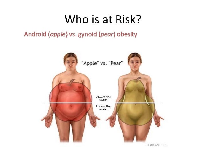 Who is at Risk? Android (apple) vs. gynoid (pear) obesity 