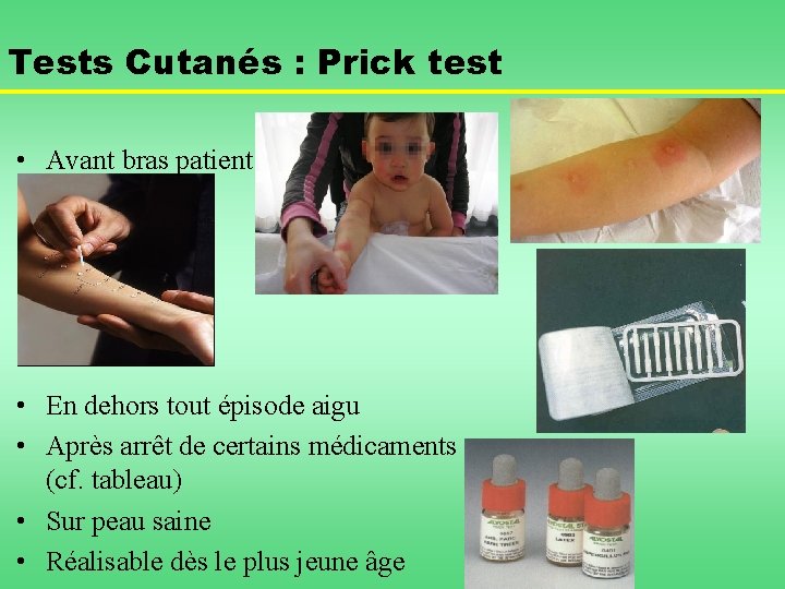 Tests Cutanés : Prick test • Avant bras patient Papules après tests cutanés •