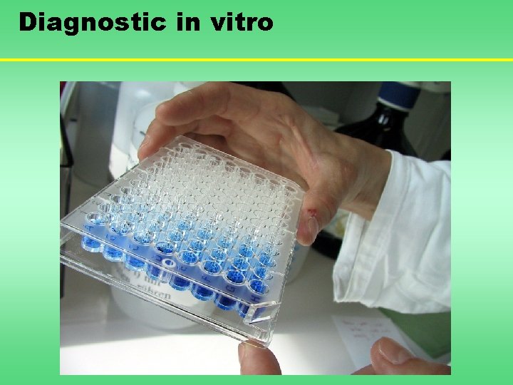 Diagnostic in vitro 