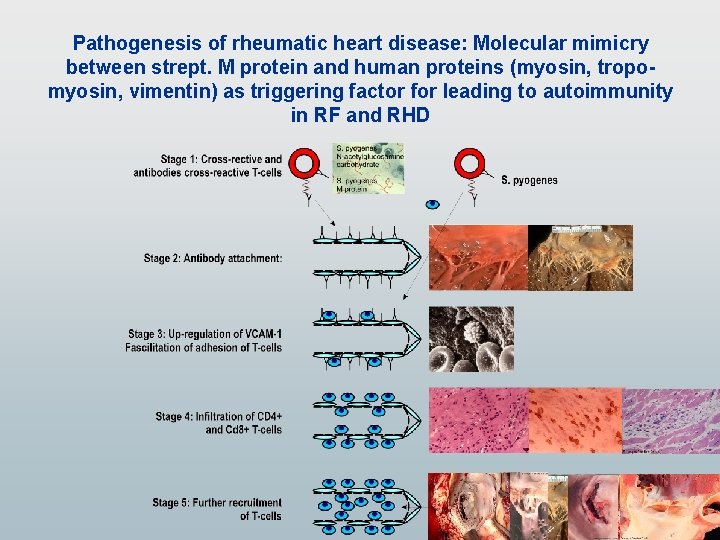 Pathogenesis of rheumatic heart disease: Molecular mimicry between strept. M protein and human proteins Pathogenesis of rheumatic heart disease: Molecular mimicry between strept. M protein and human proteins