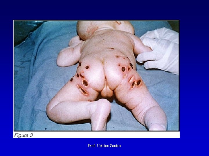 Prof. Ueliton Santos 