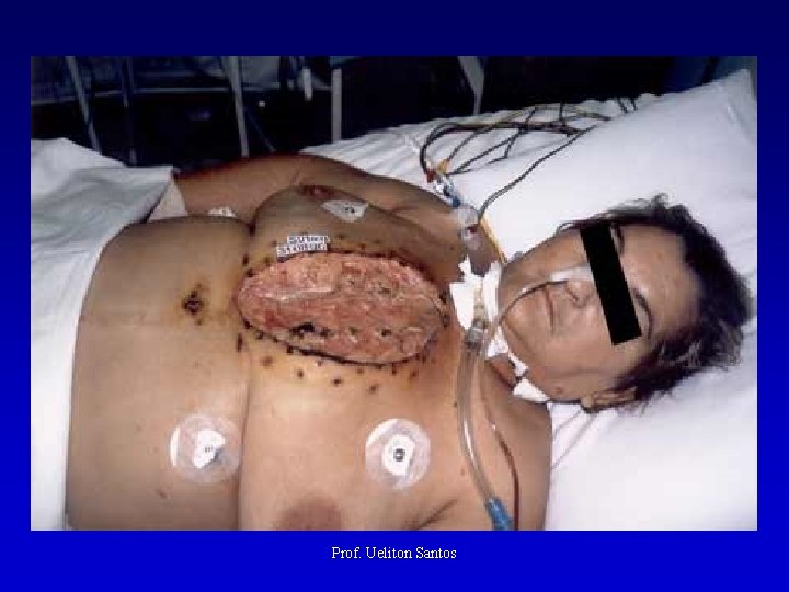 Prof. Ueliton Santos 