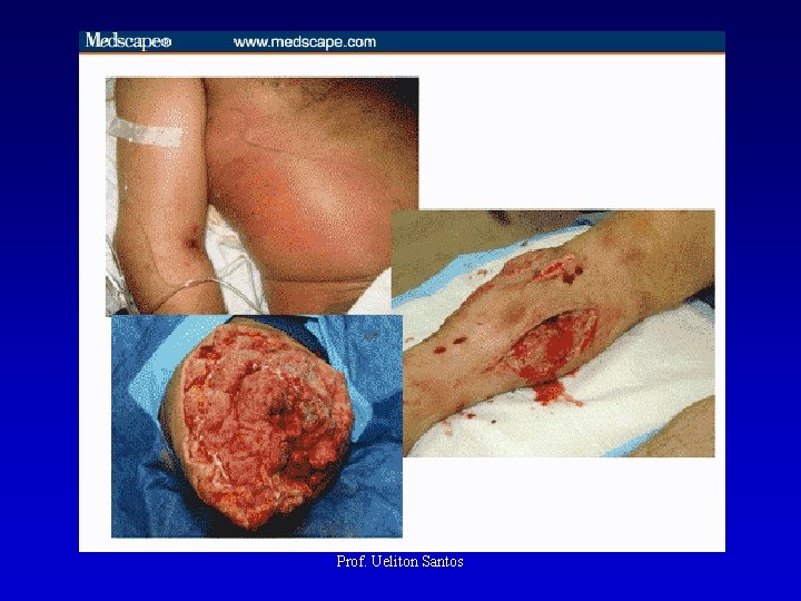 Prof. Ueliton Santos 