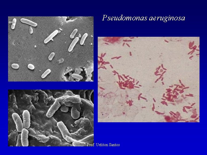 Pseudomonas aeruginosa Prof. Ueliton Santos 