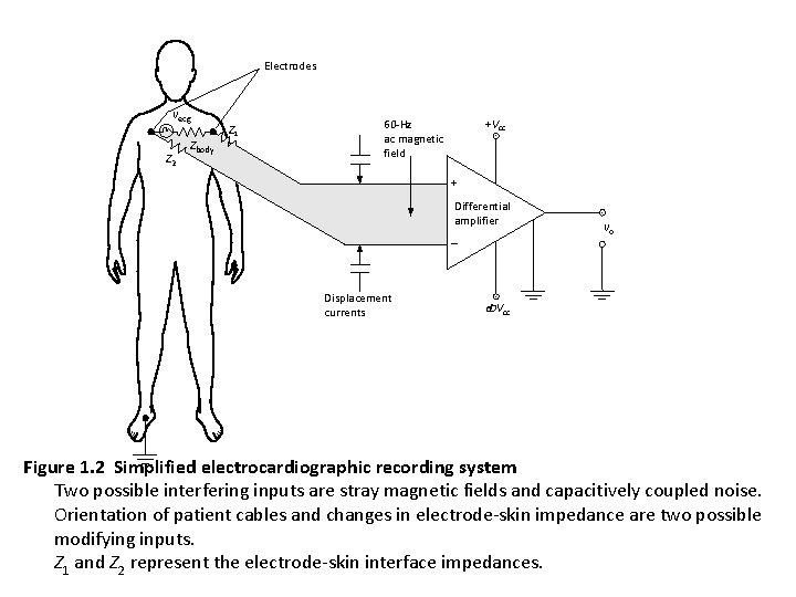 Electrodes vecg Z 2 Zbody Z 1 +Vcc 60 -Hz ac magnetic field +