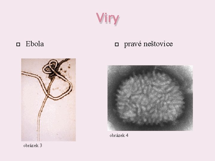 Viry Ebola pravé neštovice obrázek 4 obrázek 3 