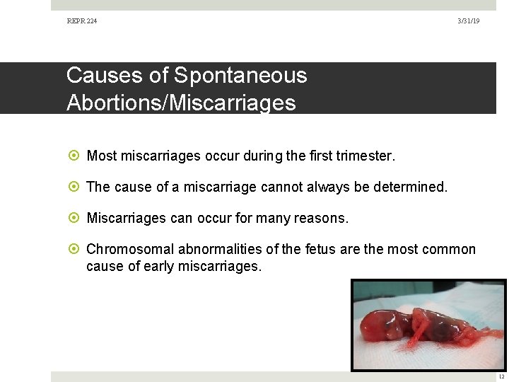 REPR 224 3/31/19 Causes of Spontaneous Abortions/Miscarriages Most miscarriages occur during the first trimester. REPR 224 3/31/19 Causes of Spontaneous Abortions/Miscarriages Most miscarriages occur during the first trimester.