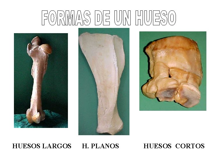 HUESOS LARGOS H. PLANOS HUESOS CORTOS 