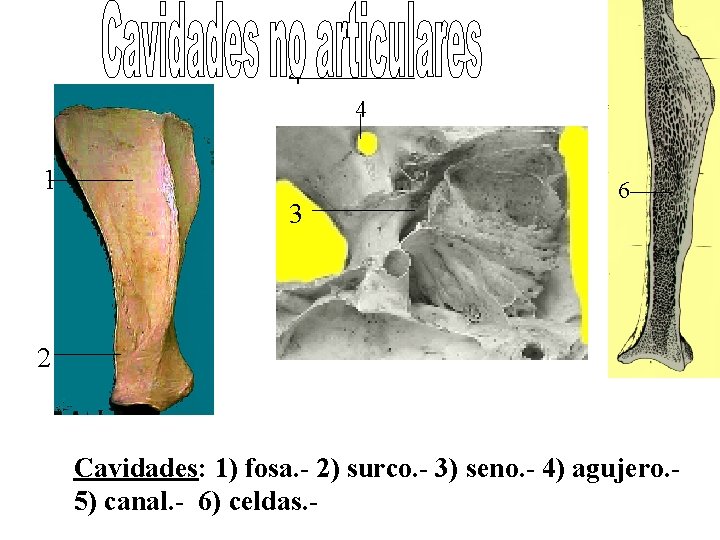 4 4 1 3 6 2 Cavidades: 1) fosa. - 2) surco. - 3)