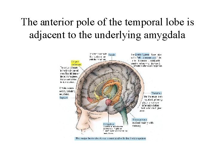 The anterior pole of the temporal lobe is adjacent to the underlying amygdala 