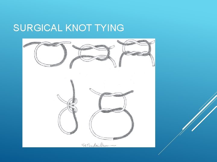 SURGICAL KNOT TYING SURGICAL KNOT TYING