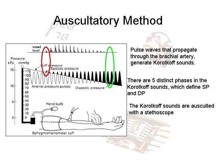 Auscultatory Method Pulse waves that propagate through the brachial artery, generate Korotkoff sounds. There