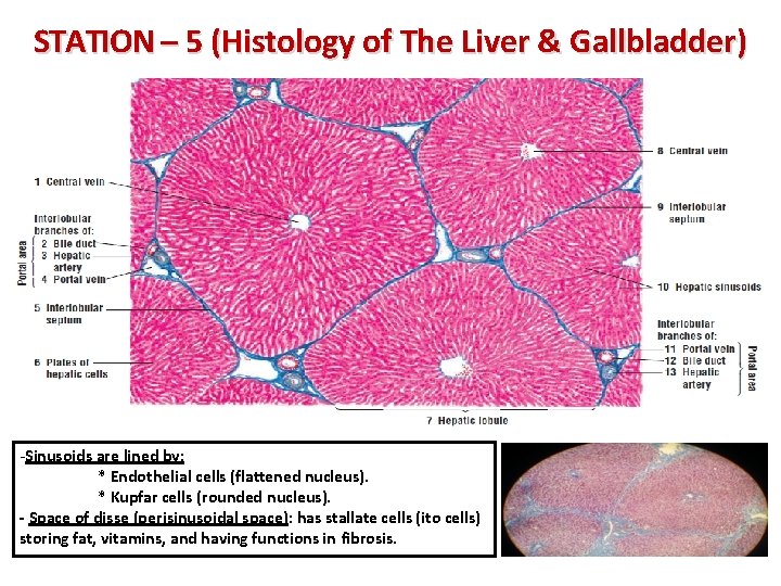 STATION – 5 (Histology of The Liver & Gallbladder) -Sinusoids are lined by: *