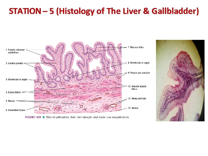 STATION – 5 (Histology of The Liver & Gallbladder) 
