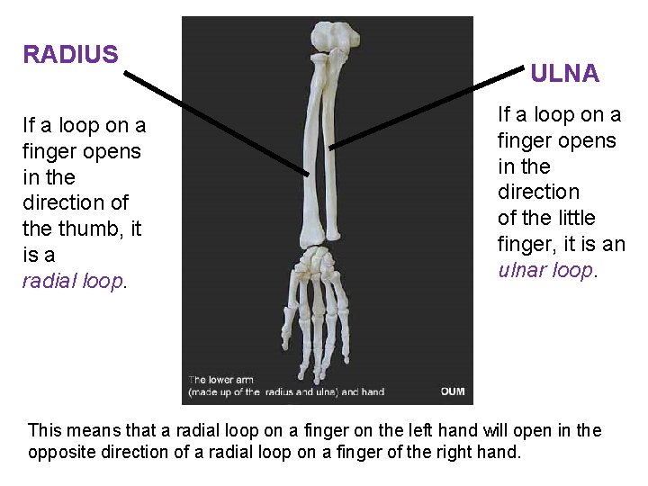 RADIUS If a loop on a finger opens in the direction of the thumb,