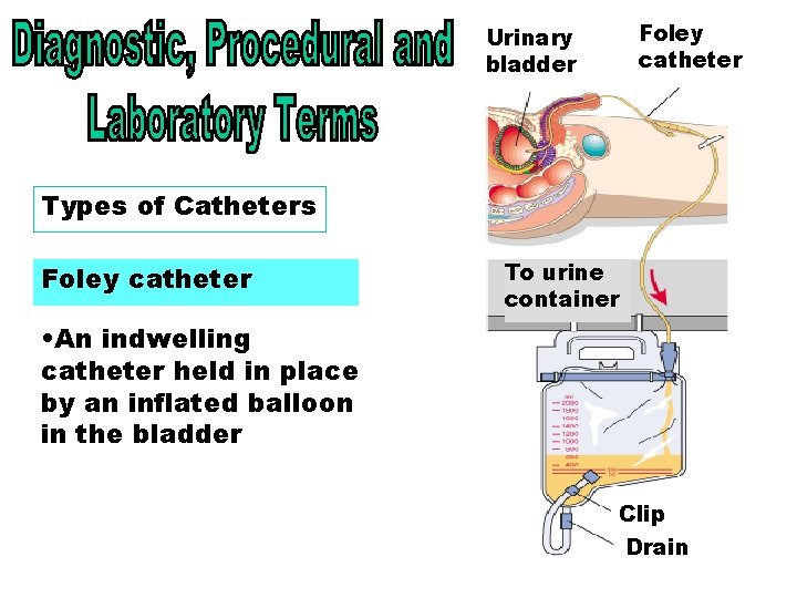 Foley catheter Urinary bladder Types of Catheters - Foley Types of Catheters Foley catheter