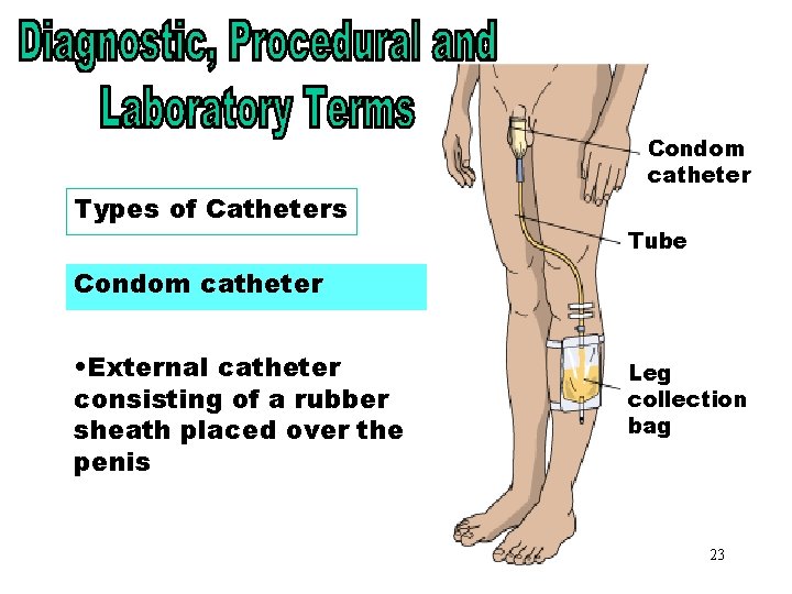 Types of Catheters - Condom Types of Catheters Condom catheter Tube Condom catheter •