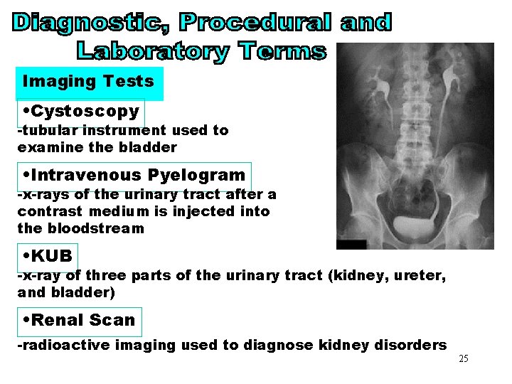 Imaging Tests • Cystoscopy -tubular instrument used to examine the bladder • Intravenous Pyelogram Imaging Tests • Cystoscopy -tubular instrument used to examine the bladder • Intravenous Pyelogram