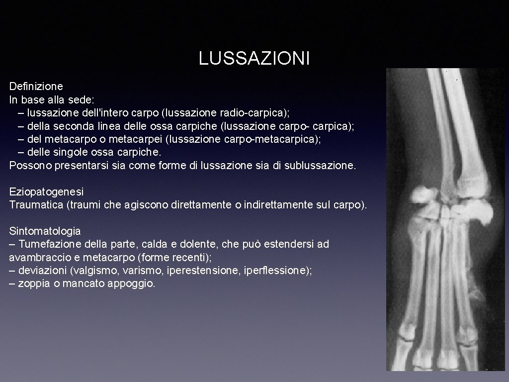 LUSSAZIONI Definizione In base alla sede: – lussazione dell'intero carpo (lussazione radio-carpica); – della