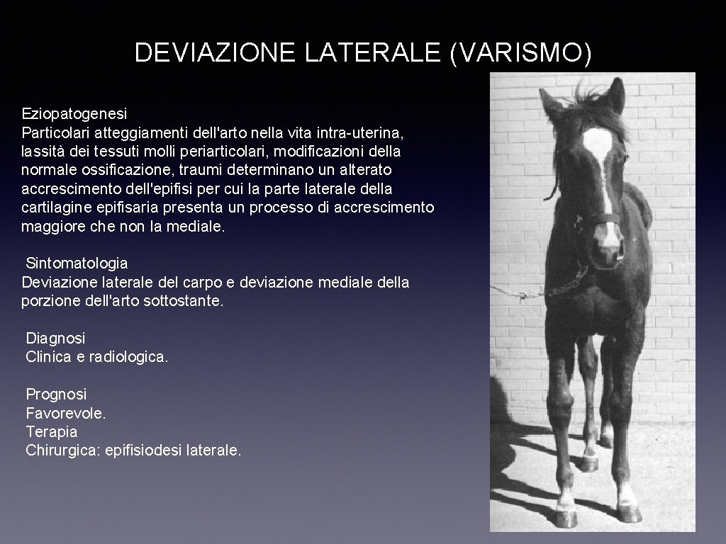 DEVIAZIONE LATERALE (VARISMO) Eziopatogenesi Particolari atteggiamenti dell'arto nella vita intra-uterina, lassità dei tessuti molli