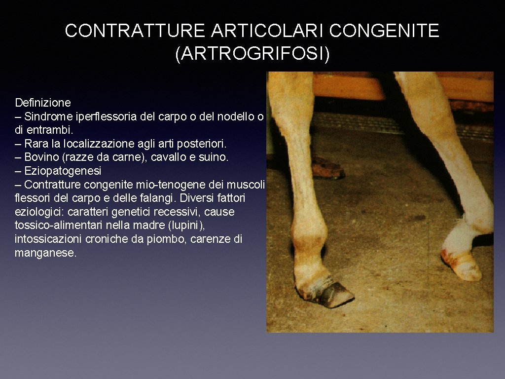 CONTRATTURE ARTICOLARI CONGENITE (ARTROGRIFOSI) Definizione – Sindrome iperflessoria del carpo o del nodello o