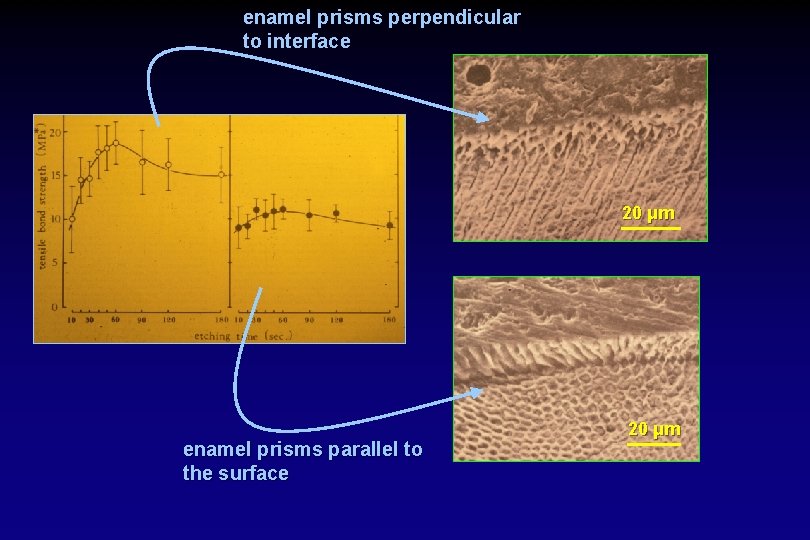 enamel prisms perpendicular to interface 20 μm enamel prisms parallel to the surface 20