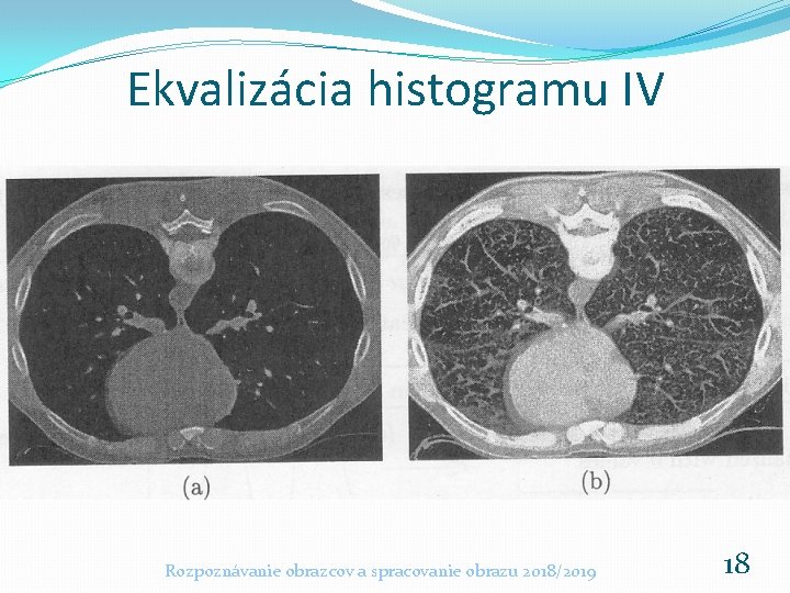 Ekvalizácia histogramu IV Rozpoznávanie obrazcov a spracovanie obrazu 2018/2019 18 Ekvalizácia histogramu IV Rozpoznávanie obrazcov a spracovanie obrazu 2018/2019 18