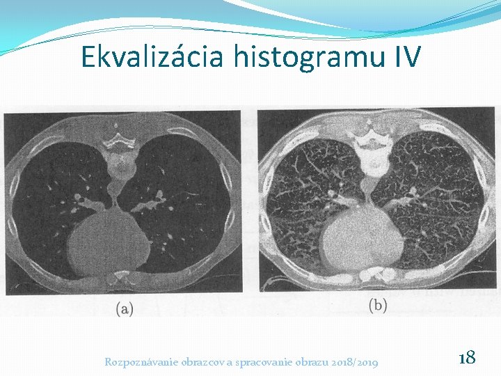 Ekvalizácia histogramu IV Rozpoznávanie obrazcov a spracovanie obrazu 2018/2019 18 