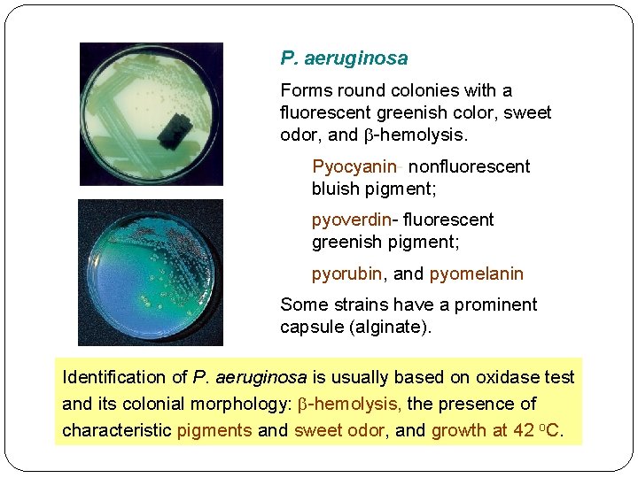 P. aeruginosa Forms round colonies with a fluorescent greenish color, sweet odor, and b-hemolysis.
