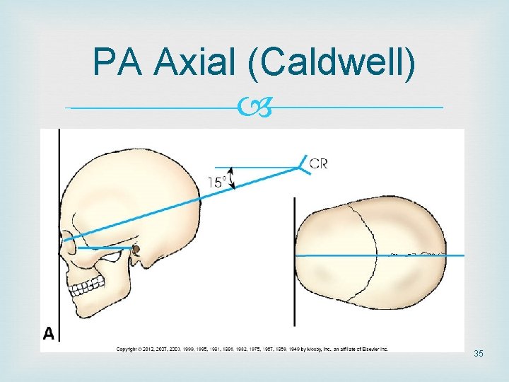 PA Axial (Caldwell) 35 PA Axial (Caldwell) 35
