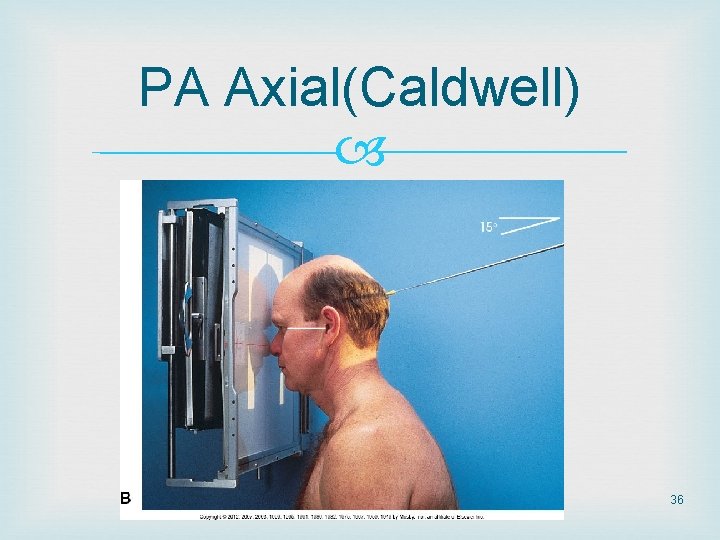 PA Axial(Caldwell) 36 PA Axial(Caldwell) 36
