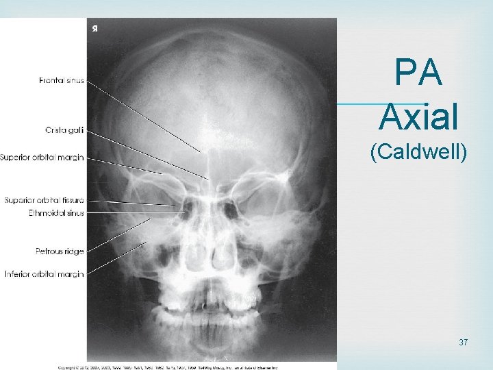 PA Axial (Caldwell) 37 PA Axial (Caldwell) 37