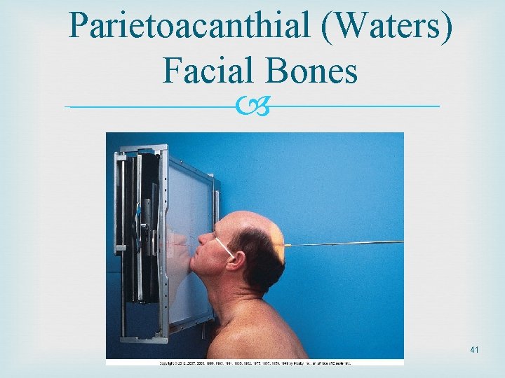 Parietoacanthial (Waters) Facial Bones 41 