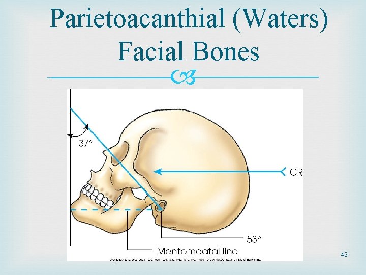 Parietoacanthial (Waters) Facial Bones 42 Parietoacanthial (Waters) Facial Bones 42