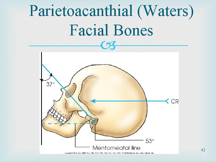 Parietoacanthial (Waters) Facial Bones 42 