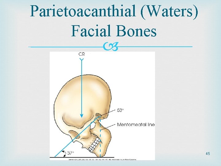 Parietoacanthial (Waters) Facial Bones 45 Parietoacanthial (Waters) Facial Bones 45