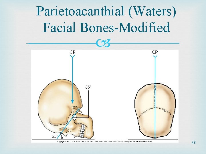 Parietoacanthial (Waters) Facial Bones-Modified 48 