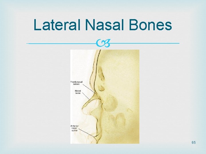 Lateral Nasal Bones 65 Lateral Nasal Bones 65