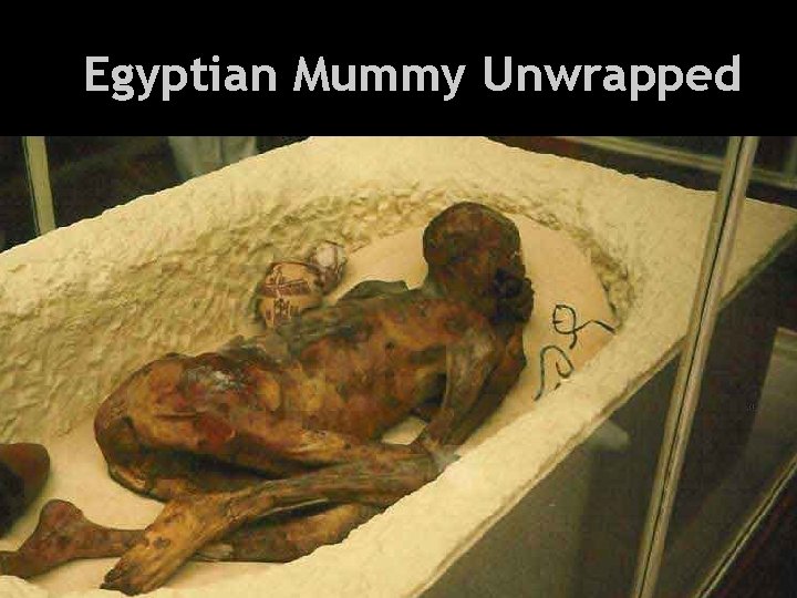 Health and Everything Egyptian Mummy Unwrapped 