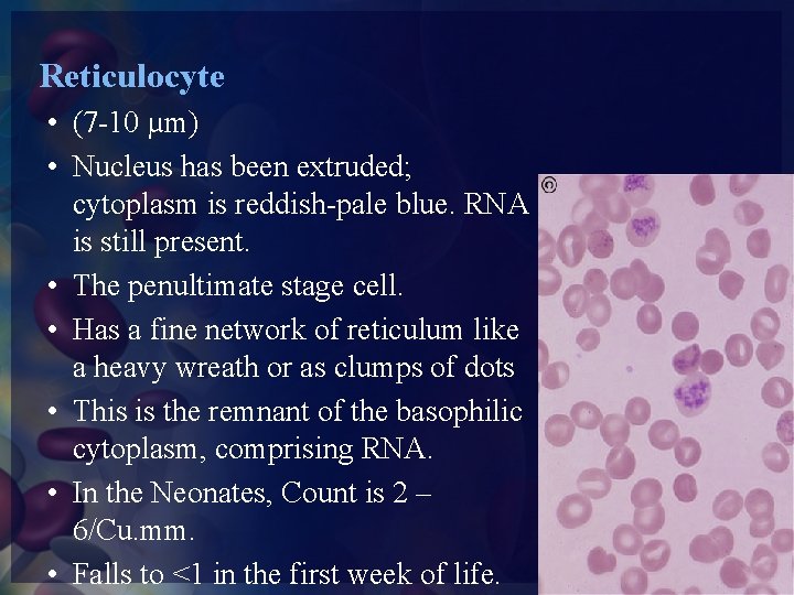 Reticulocyte • (7 -10 µm) • Nucleus has been extruded; cytoplasm is reddish-pale blue.
