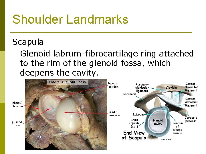 Shoulder Landmarks Scapula Glenoid labrum-fibrocartilage ring attached to the rim of the glenoid fossa,