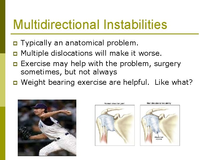 Multidirectional Instabilities p p Typically an anatomical problem. Multiple dislocations will make it worse.