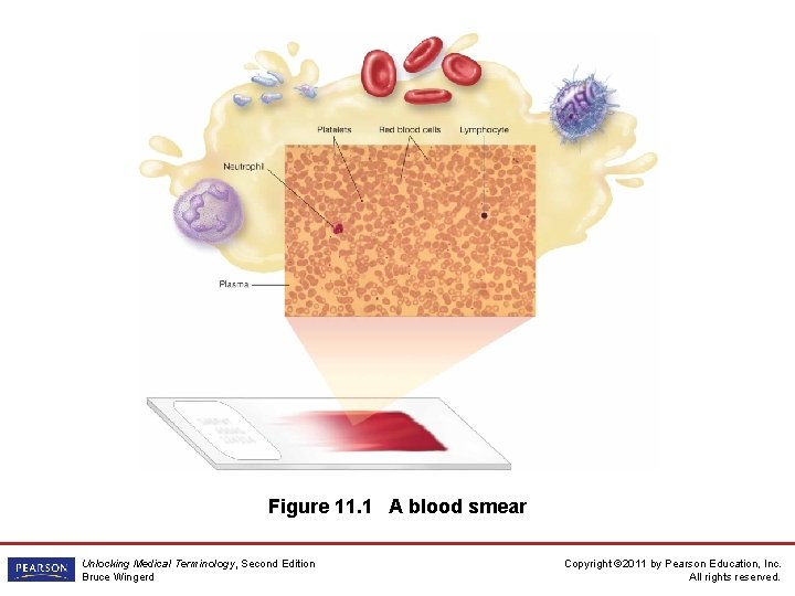 Figure 11. 1 A blood smear Unlocking Medical Terminology, Second Edition Bruce Wingerd Copyright