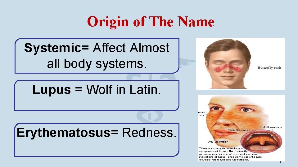 Origin of The Name Systemic= Affect Almost all body systems. Lupus = Wolf in