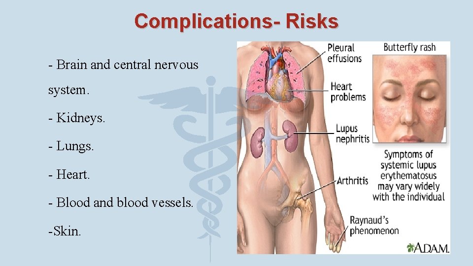 Complications- Risks ¨ - Brain and central nervous system. ¨ - Kidneys. ¨ -