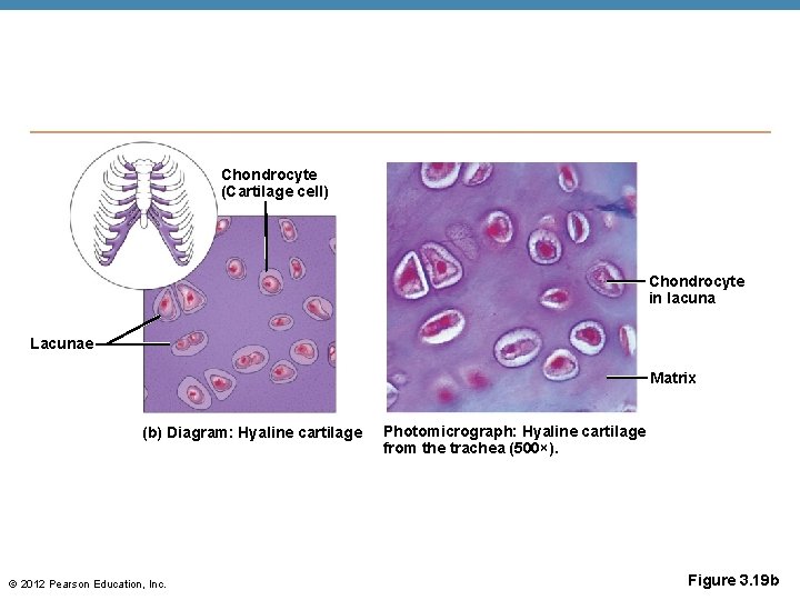 Chondrocyte (Cartilage cell) Chondrocyte in lacuna Lacunae Matrix (b) Diagram: Hyaline cartilage © 2012