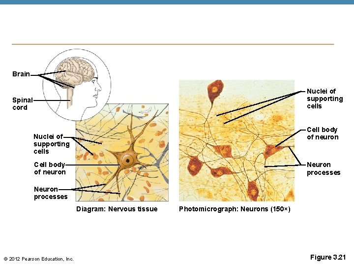 Brain Nuclei of supporting cells Spinal cord Cell body of neuron Nuclei of supporting