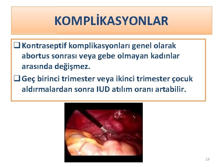 KOMPLİKASYONLAR q Kontraseptif komplikasyonları genel olarak abortus sonrası veya gebe olmayan kadınlar arasında değişmez.