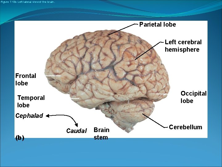 Figure 7. 13 b Left lateral view of the brain. Parietal lobe Left cerebral
