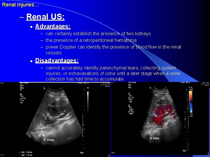 Renal Injuries… – Renal US: l Advantages: – can certainly establish the presence of